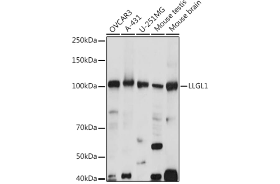 Western Blot - Anti-LLGL1 Antibody (A307538) - Antibodies.com