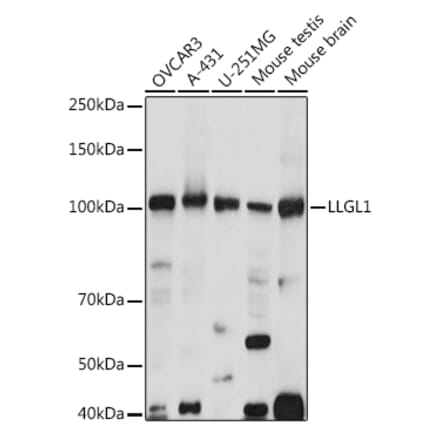 Western Blot - Anti-LLGL1 Antibody (A307538) - Antibodies.com