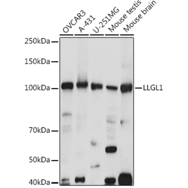 Western Blot - Anti-LLGL1 Antibody (A307538) - Antibodies.com