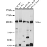 Western Blot - Anti-LLGL1 Antibody (A307538) - Antibodies.com