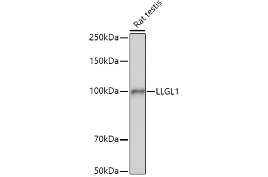 Western Blot - Anti-LLGL1 Antibody (A307538) - Antibodies.com