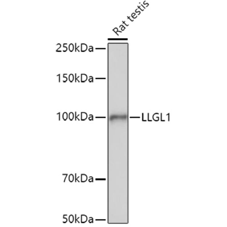 Western Blot - Anti-LLGL1 Antibody (A307538) - Antibodies.com