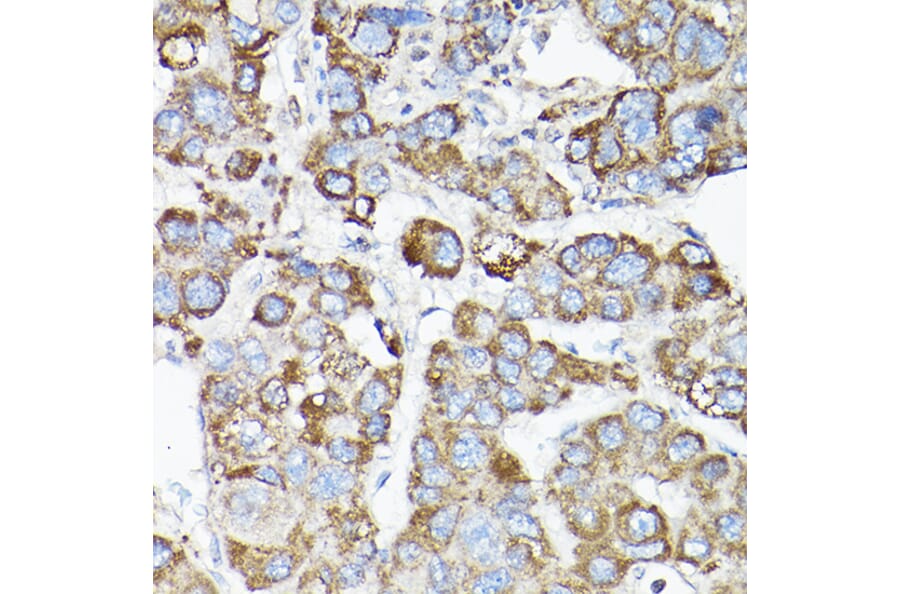 Immunohistochemistry - Anti-LLGL1 Antibody (A307538) - Antibodies.com