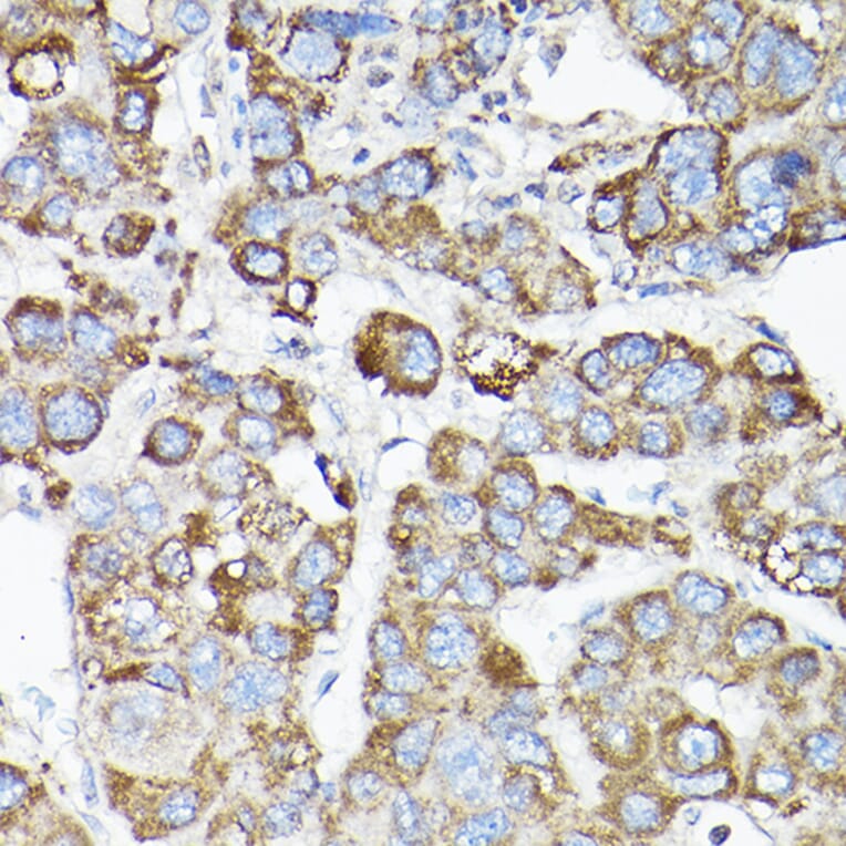 Immunohistochemistry - Anti-LLGL1 Antibody (A307538) - Antibodies.com