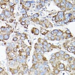 Immunohistochemistry - Anti-LLGL1 Antibody (A307538) - Antibodies.com