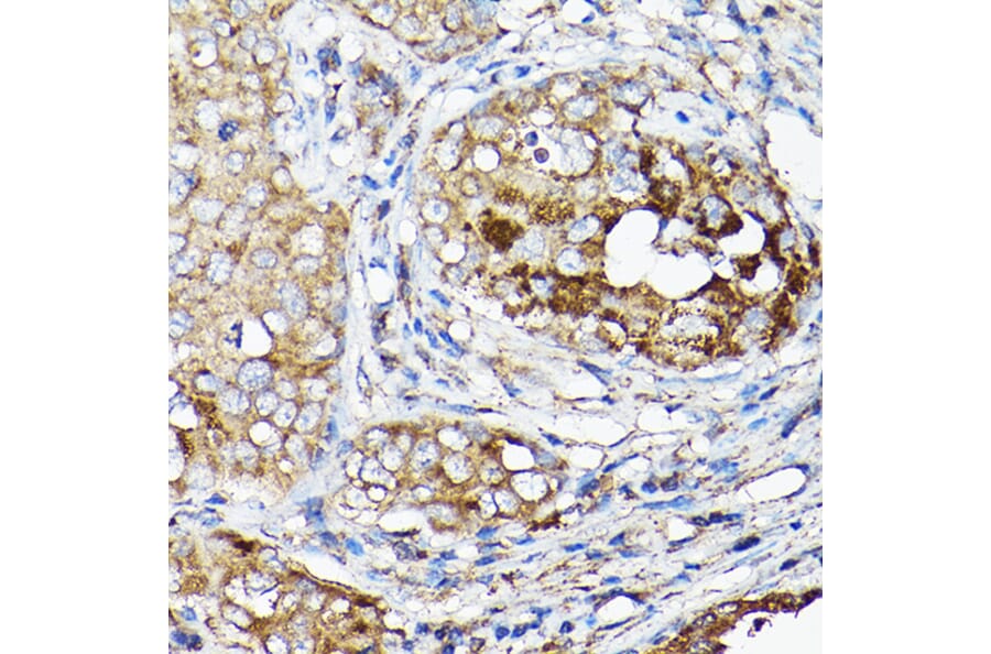 Immunohistochemistry - Anti-LLGL1 Antibody (A307538) - Antibodies.com
