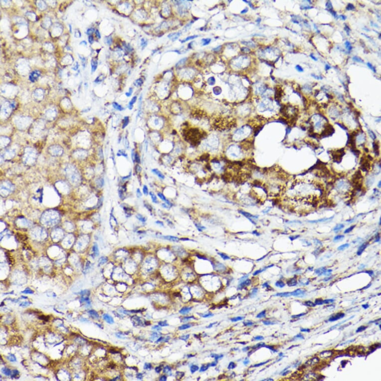 Immunohistochemistry - Anti-LLGL1 Antibody (A307538) - Antibodies.com