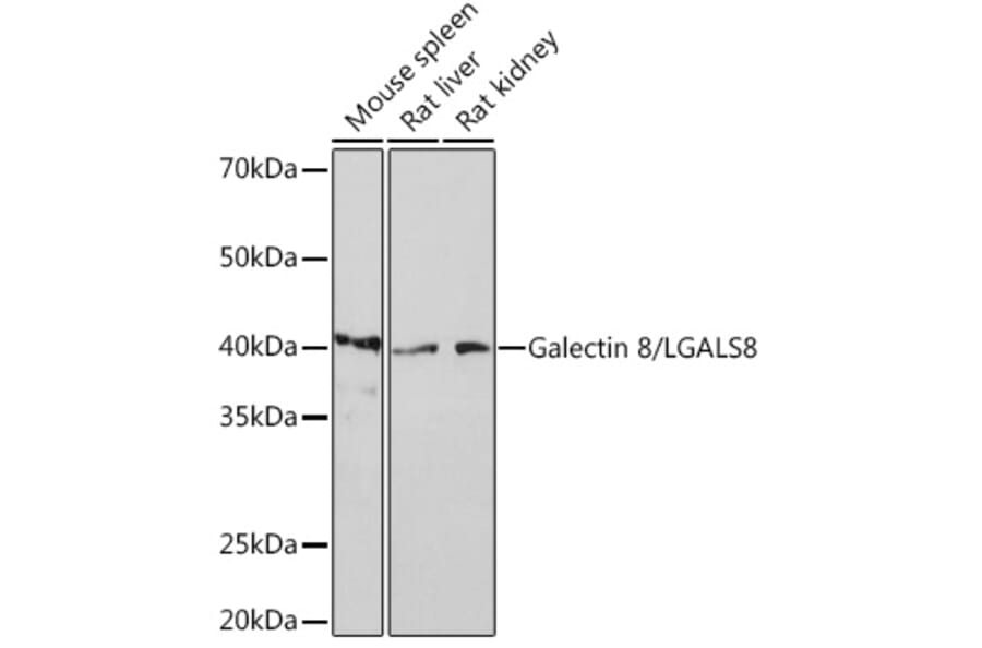 Western Blot - Anti-Galectin 8/Gal-8 Antibody [ARC0990] (A307539) - Antibodies.com