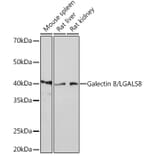 Western Blot - Anti-Galectin 8/Gal-8 Antibody [ARC0990] (A307539) - Antibodies.com