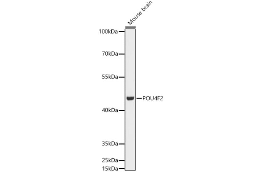 Western Blot - Anti-BRN3B/POU4F2 Antibody (A307540) - Antibodies.com