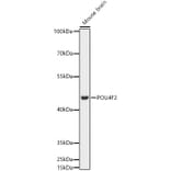 Western Blot - Anti-BRN3B/POU4F2 Antibody (A307540) - Antibodies.com