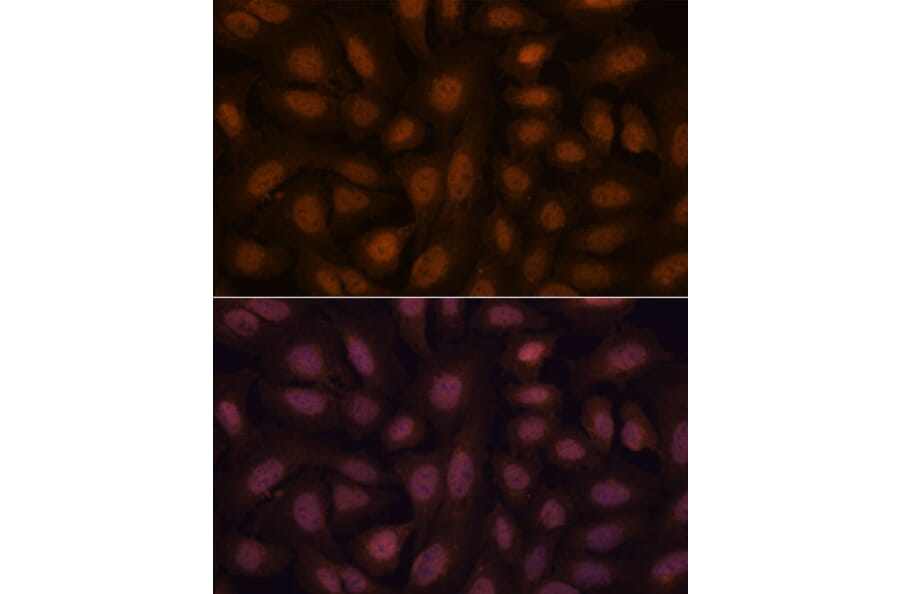 Immunofluorescence - Anti-BRN3B/POU4F2 Antibody (A307540) - Antibodies.com