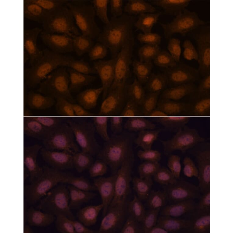 Immunofluorescence - Anti-BRN3B/POU4F2 Antibody (A307540) - Antibodies.com
