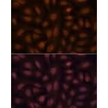 Immunofluorescence - Anti-BRN3B/POU4F2 Antibody (A307540) - Antibodies.com