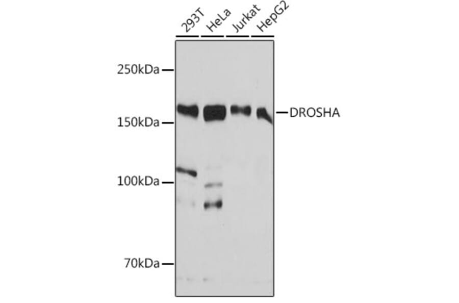 Western Blot - Anti-Drosha Antibody [ARC0077] (A307542) - Antibodies.com