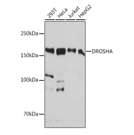 Western Blot - Anti-Drosha Antibody [ARC0077] (A307542) - Antibodies.com