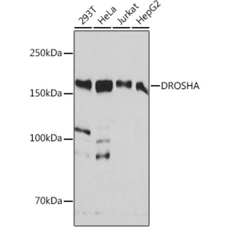 Western Blot - Anti-Drosha Antibody [ARC0077] (A307542) - Antibodies.com