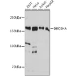 Western Blot - Anti-Drosha Antibody [ARC0077] (A307542) - Antibodies.com