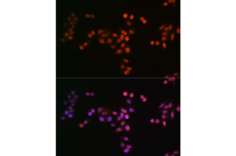 Immunofluorescence - Anti-Drosha Antibody [ARC0077] (A307542) - Antibodies.com