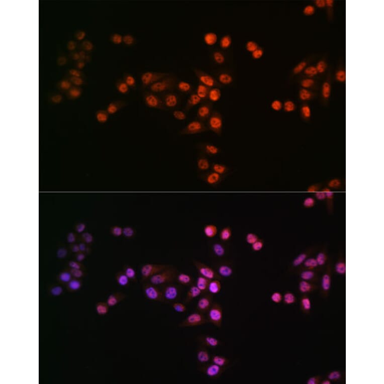 Immunofluorescence - Anti-Drosha Antibody [ARC0077] (A307542) - Antibodies.com