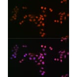 Immunofluorescence - Anti-Drosha Antibody [ARC0077] (A307542) - Antibodies.com