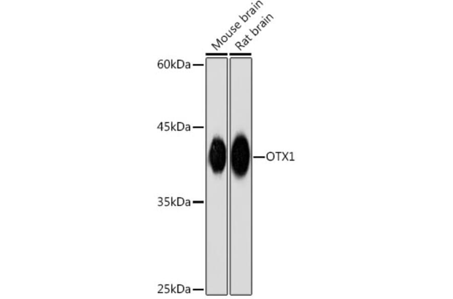 Western Blot - Anti-Otx1 Antibody [ARC2264] (A307544) - Antibodies.com
