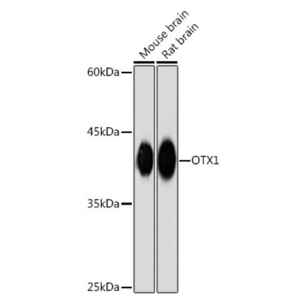 Western Blot - Anti-Otx1 Antibody [ARC2264] (A307544) - Antibodies.com