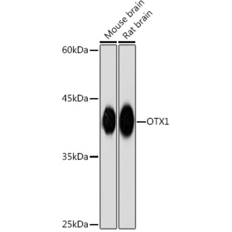 Western Blot - Anti-Otx1 Antibody [ARC2264] (A307544) - Antibodies.com