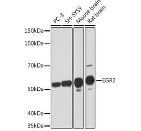 Western Blot - Anti-EGR2 Antibody [ARC1932] (A307545) - Antibodies.com