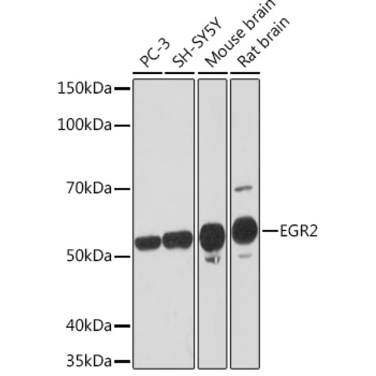Western Blot - Anti-EGR2 Antibody [ARC1932] (A307545) - Antibodies.com