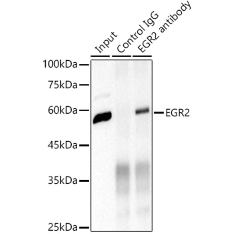 Western Blot - Anti-EGR2 Antibody [ARC1932] (A307545) - Antibodies.com