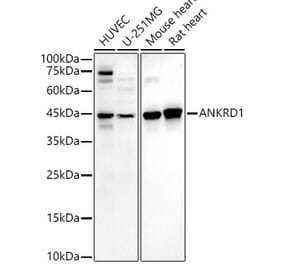 Western Blot - Anti-ANKRD1 Antibody [ARC55780 + ARC55783] (A307547) - Antibodies.com
