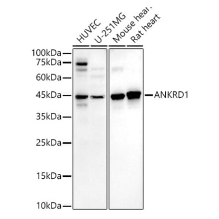 Western Blot - Anti-ANKRD1 Antibody [ARC55780 + ARC55783] (A307547) - Antibodies.com