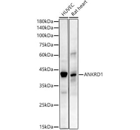 Western Blot - Anti-ANKRD1 Antibody [ARC55783] (A307548) - Antibodies.com
