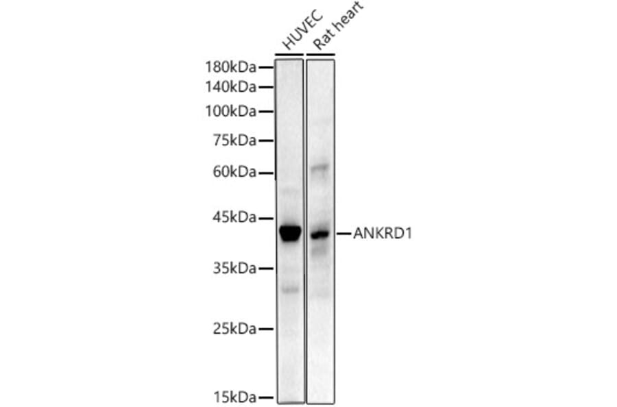Western Blot - Anti-ANKRD1 Antibody [ARC55783] (A307548) - Antibodies.com
