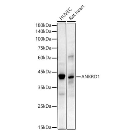 Western Blot - Anti-ANKRD1 Antibody [ARC55783] (A307548) - Antibodies.com