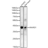 Western Blot - Anti-ANKRD1 Antibody [ARC55783] (A307548) - Antibodies.com