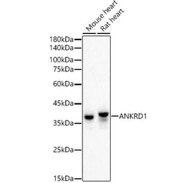 Western Blot - Anti-ANKRD1 Antibody [ARC55780] (A307549) - Antibodies.com