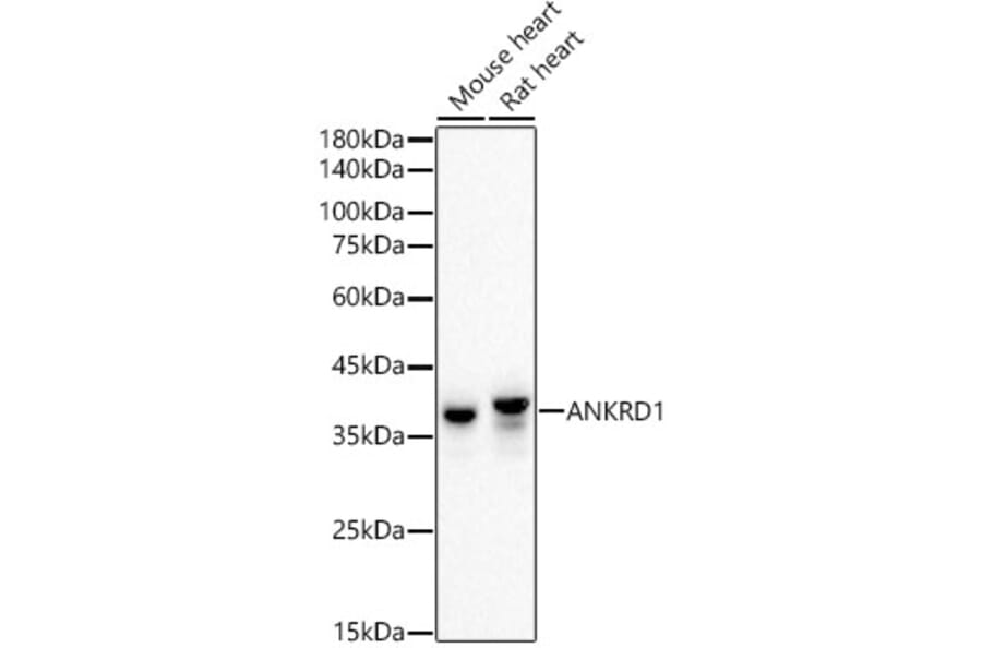 Western Blot - Anti-ANKRD1 Antibody [ARC55780] (A307549) - Antibodies.com