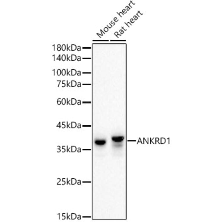 Western Blot - Anti-ANKRD1 Antibody [ARC55780] (A307549) - Antibodies.com