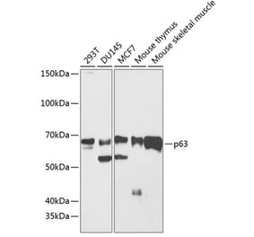 Western Blot - Anti-p63 Antibody [ARC0131] (A307550) - Antibodies.com