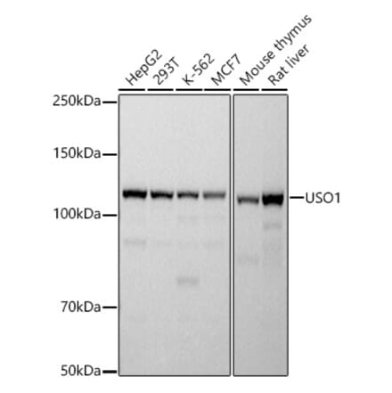 Western Blot - Anti-USO1 Antibody [ARC2937] (A307551) - Antibodies.com