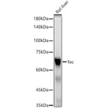 Western Blot - Anti-Tec Antibody [ARC53949] (A307552) - Antibodies.com