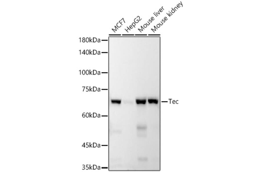 Western Blot - Anti-Tec Antibody [ARC53949] (A307552) - Antibodies.com