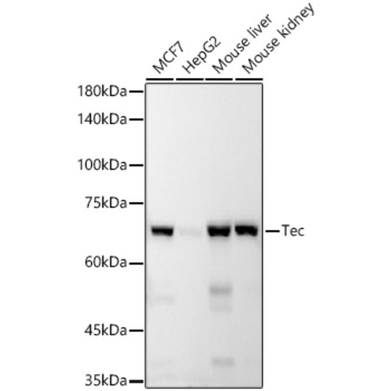 Western Blot - Anti-Tec Antibody [ARC53949] (A307552) - Antibodies.com