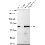 Western Blot - Anti-Tec Antibody [ARC53949] (A307552) - Antibodies.com