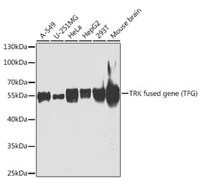 Western Blot - Anti-TRK fused gene Antibody (A307553) - Antibodies.com