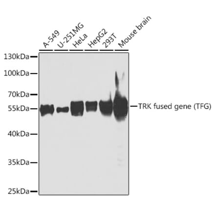 Western Blot - Anti-TRK fused gene Antibody (A307553) - Antibodies.com