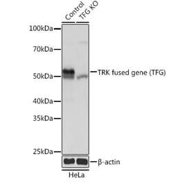 Western Blot - Anti-TRK fused gene Antibody (A307554) - Antibodies.com