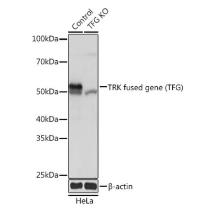 Western Blot - Anti-TRK fused gene Antibody (A307554) - Antibodies.com